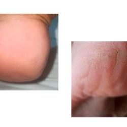PediFix Podología Clínica