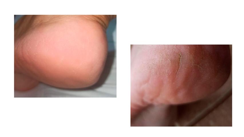 PediFix Podología Clínica