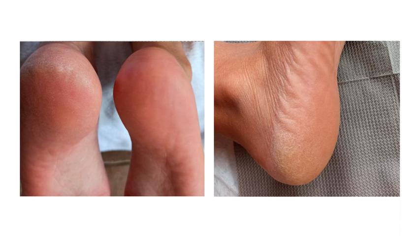PediFix Podología Clínica
