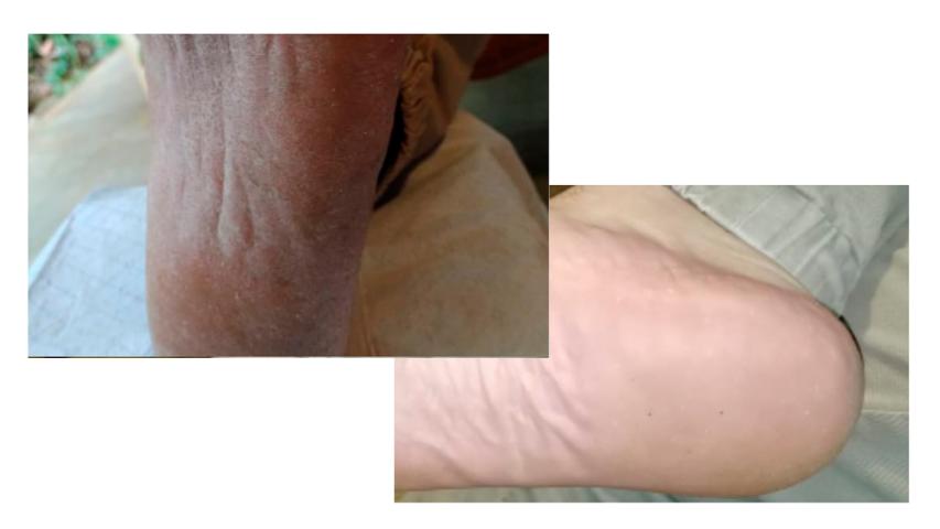 PediFix Podología Clínica